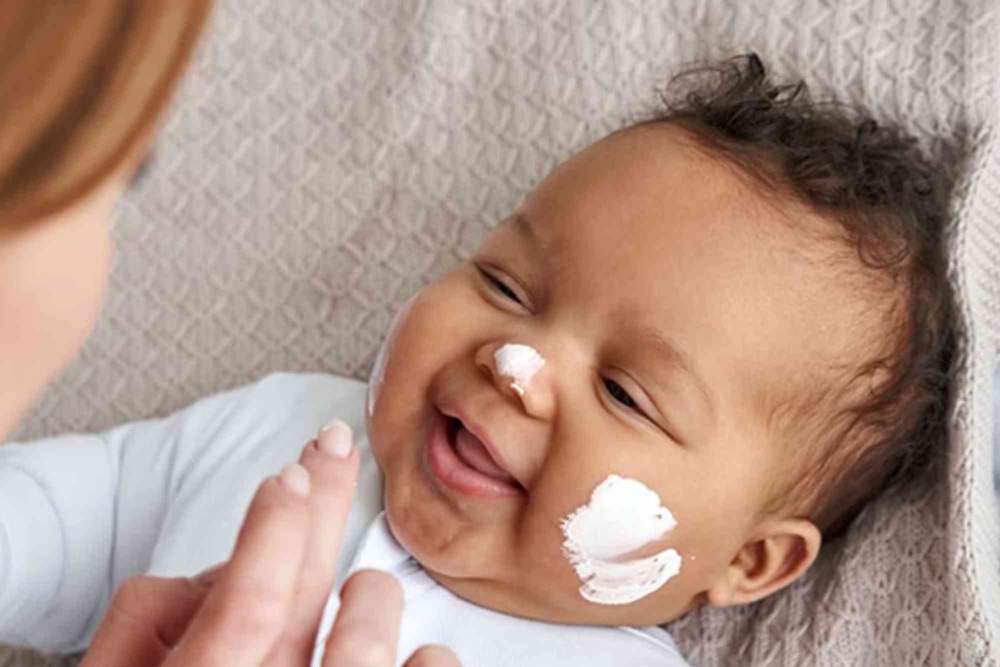 Top Baby Skin Care Products to Avoid Rashes and Allergies